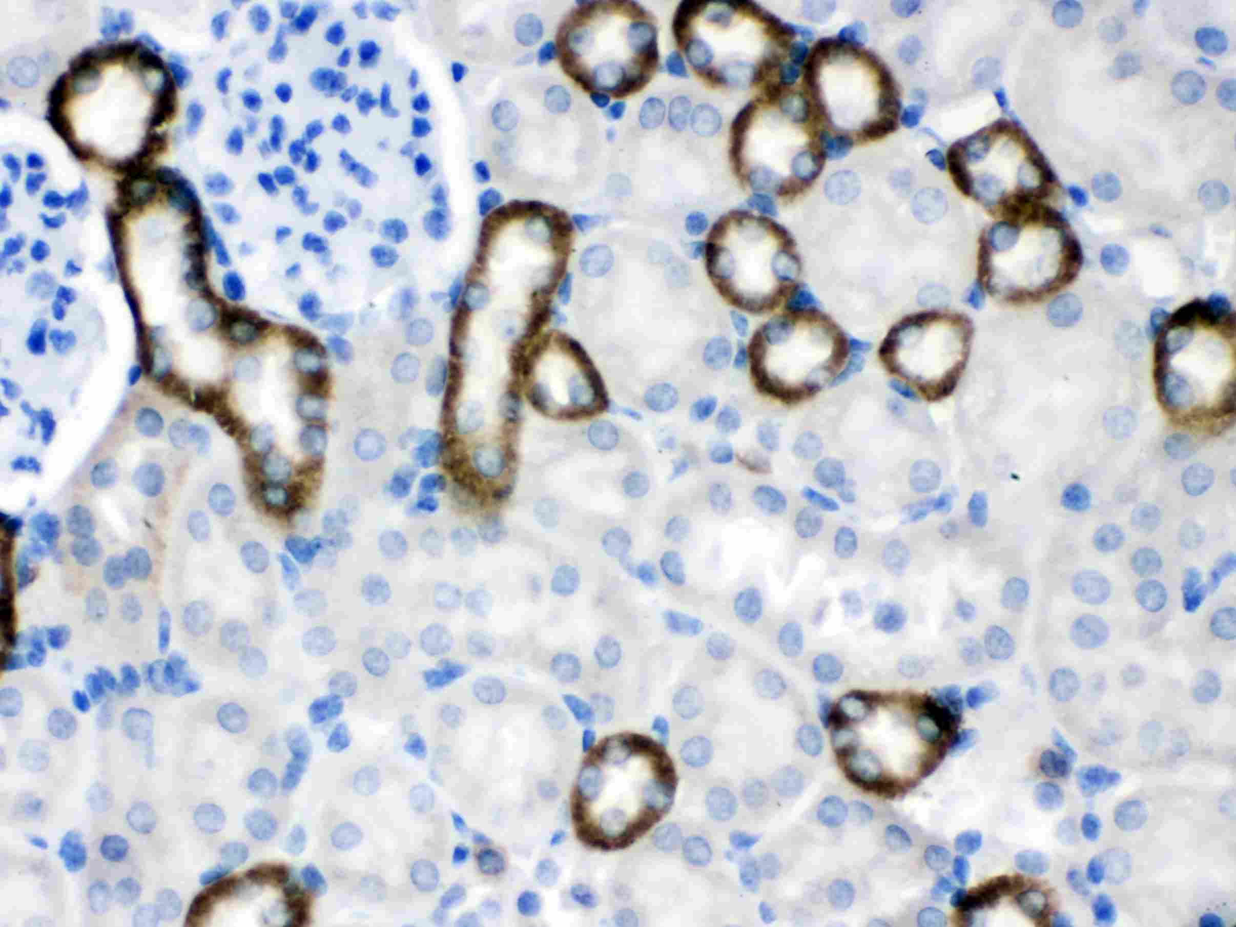 Anti-Calcium Sensing Receptor/CASR Antibody Picoband&reg;