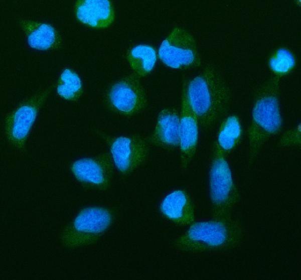 pb9925 catalase primary antibodies if testing 1