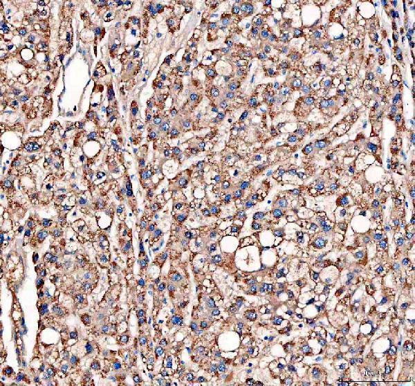 pb9925 catalase primary antibodies ihc testing 1