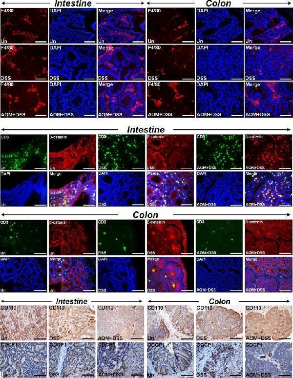 Recruitment of immune cells and evidence of local spread
