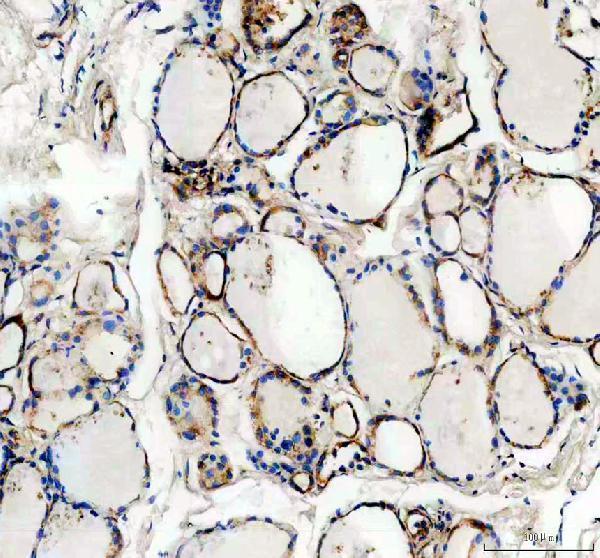 IHC analysis of CGRP using anti-CGRP antibody (PB9936)