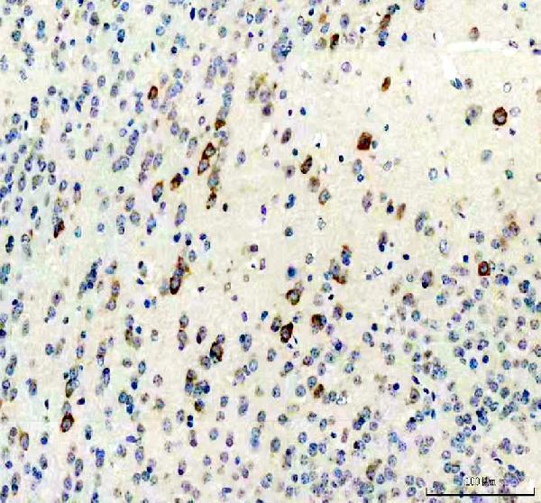 IHC analysis of Survivin/Calcitonin/CALCA using anti-Survivin/Calcitonin/CALCA antibody (PB9937)