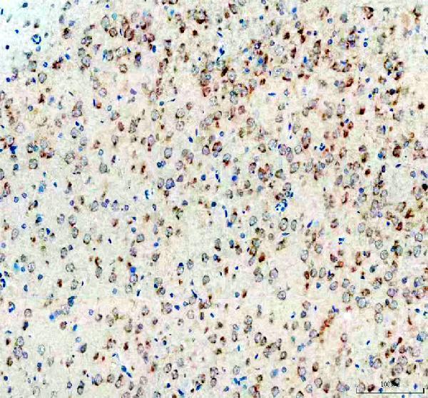 IHC analysis of Survivin/Calcitonin/CALCA using anti-Survivin/Calcitonin/CALCA antibody (PB9937)