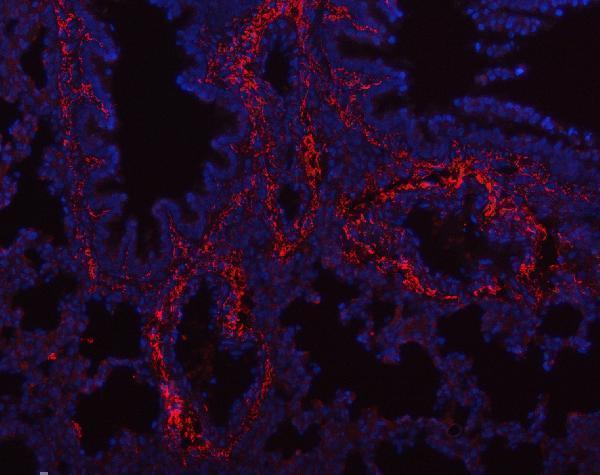 pb9938 col1a1 primary antibodies if testing 11