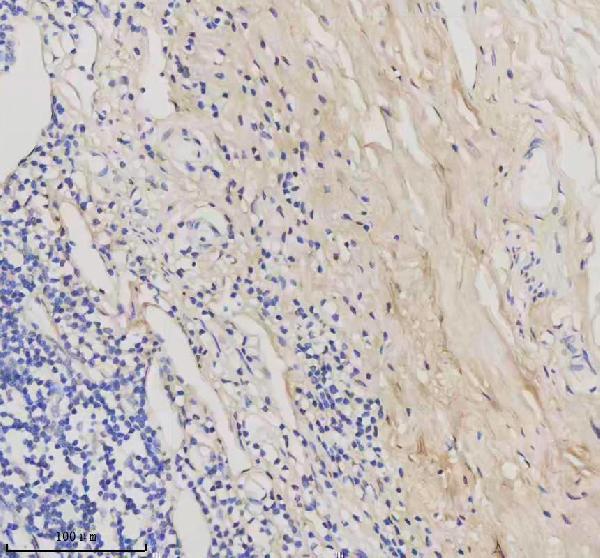 pb9938 col1a1 primary antibodies ihc testing 10