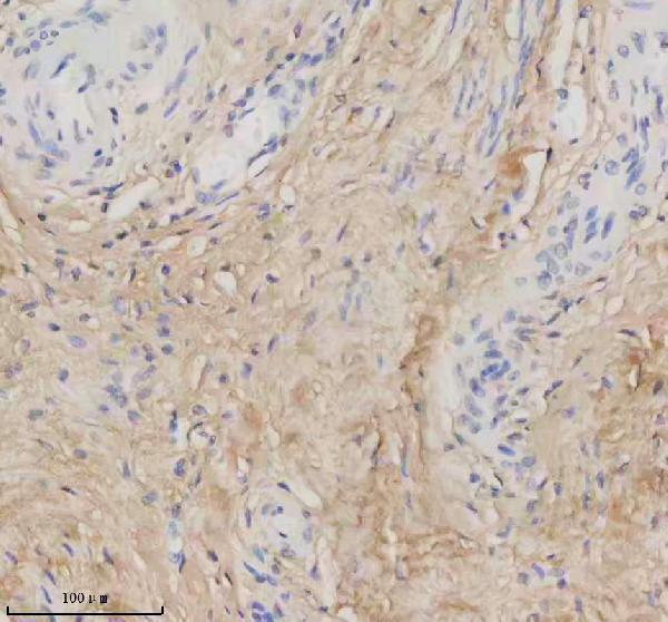 pb9938 col1a1 primary antibodies ihc testing 8_1