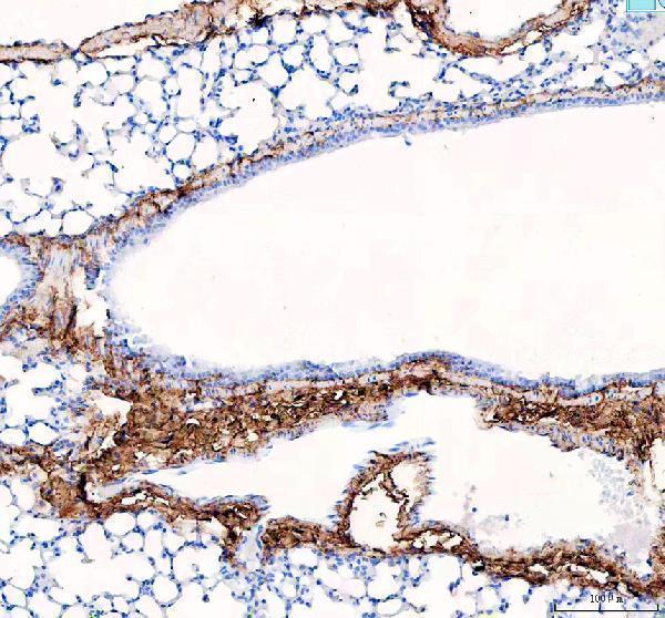 pb9939 col1a1 primary antibodies ihc testing 1