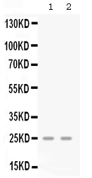 Anti-GRO gamma/CXCL3 Antibody Picoband&reg;