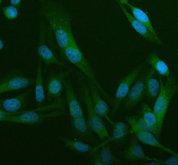 pb9962 wdr1 primary antibodies if testing 1