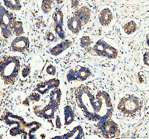 pb9962 wdr1 primary antibodies ihc testing 1