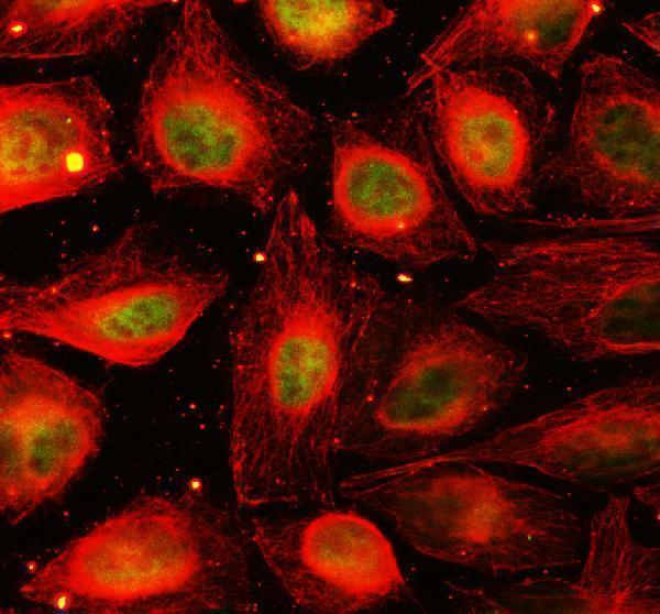 pb9967 yap1 primary antibodies if testing 9