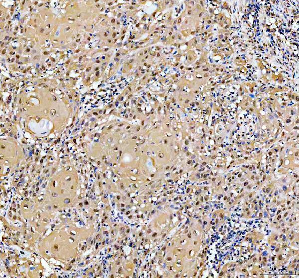  IHC analysis of YAP1 using anti-YAP1 antibody (PB9967)