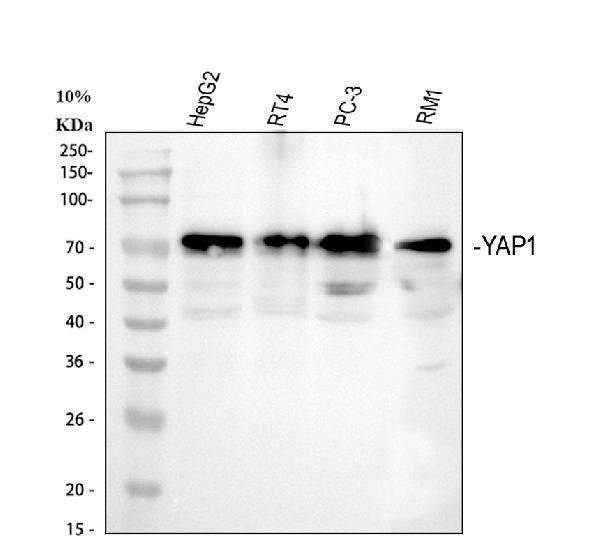  Western blot analysis of YAP1 using anti-YAP1 antibody (PB9967)