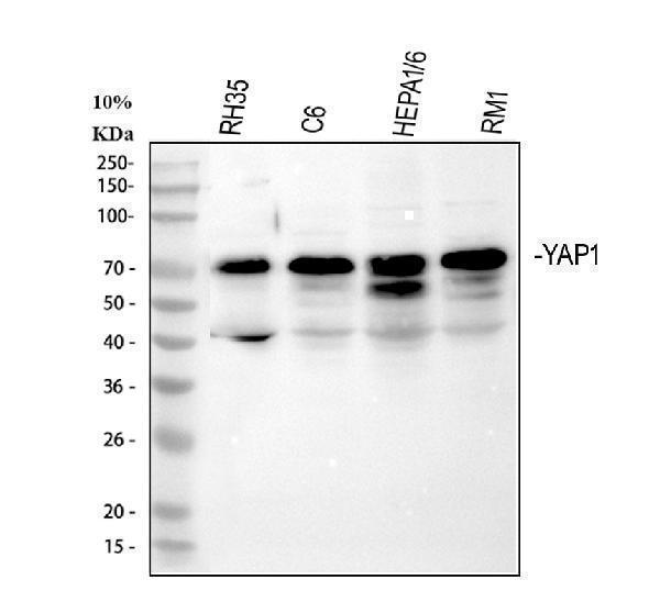  Western blot analysis of YAP1 using anti-YAP1 antibody (PB9967)