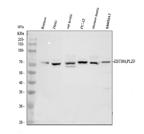 Western blot analysis of Plzf/ZBTB16 using anti-Plzf/ZBTB16 antibody (PB9969)