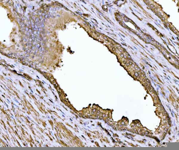 pb9974 actn4 primary antibodies ihc testing 4