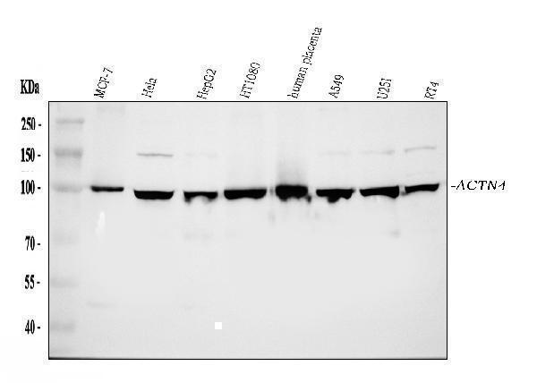pb9974 actn4 primary antibodies wb testing 1