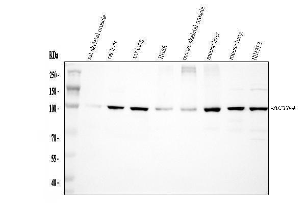 pb9974 actn4 primary antibodies wb testing 2