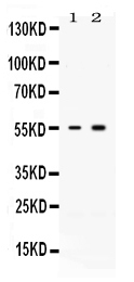 Anti-Activin Receptor Type IIB/ACVR2B Antibody Picoband&reg;