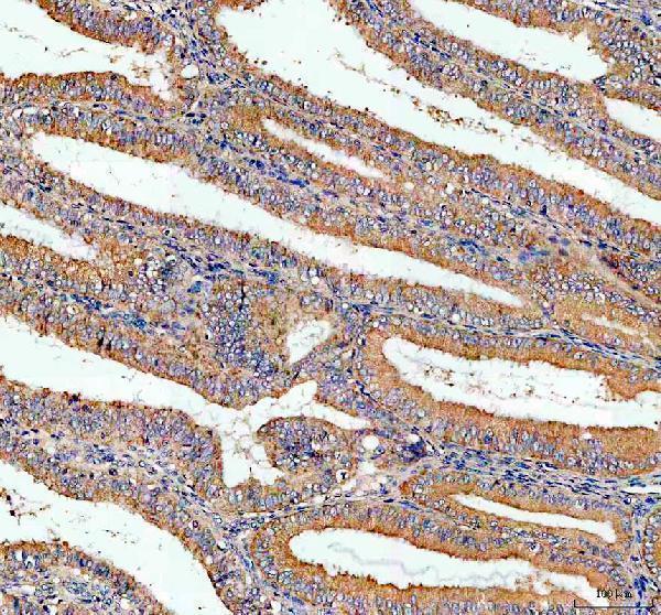 IHC analysis of AGO4 using anti-AGO4 antibody (PB9979)