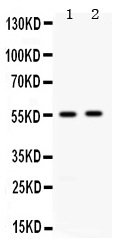 Anti-ALDH3A2 Antibody Picoband&reg;