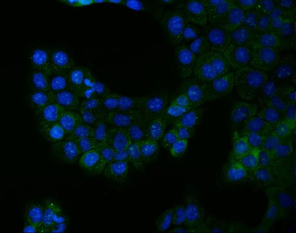 Figure 2. IF analysis of Bcr using anti-Bcr antibody (PB9988). Bcr was detected in an immunocytochemical section of A431 cells. Enzyme antigen retrieval was performed using IHC enzyme antigen retrieval reagent (AR0022) for 15 mins. The cells were blocked with 10% goat serum. And then incubated with 5 microg/mL rabbit anti-Bcr Antibody (PB9988) overnight at 4°C. DyLight®488 Conjugated Goat Anti-Rabbit IgG (BA1127) was used as secondary antibody at 1:100 dilution and incubated for 30 minutes at 37°C. The section was counterstained with DAPI. Visualize using a fluorescence microscope and filter sets appropriate for the label used.