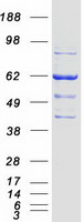 Coomassie blue staining of purified ILVBL protein
