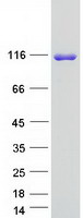 Coomassie blue staining of purified SH3PXD2B protein