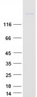 Coomassie blue staining of purified NBAS protein
