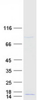 prota2ru37 c9orf170 human recombinant protein