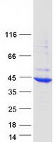 Coomassie blue staining of purified HYKK protein