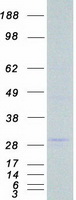 prota4qpb2 lrp5l human recombinant protein