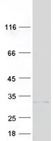 Coomassie blue staining of purified TMEM189 protein