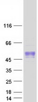 Coomassie blue staining of purified BTBD17 protein