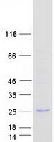 Coomassie blue staining of purified URAD protein