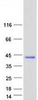 prota6ni79 ccdc69 human recombinant protein