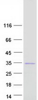 Coomassie blue staining of purified UNC119B protein