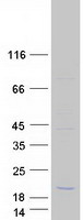prota6nji1 c11orf86 human recombinant protein