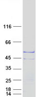 Coomassie blue staining of purified TSPY2 protein