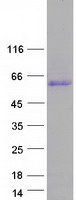 prota6nkd9 ccdc85c human recombinant protein