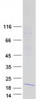 Coomassie blue staining of purified IFITM5 protein