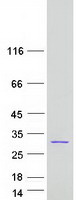 prota6nnp5 ccdc169 human recombinant protein
