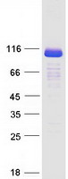 protb1ak53 espin espn human recombinant protein