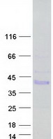 Coomassie blue staining of purified PRR32 protein