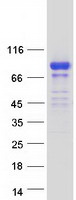 Coomassie blue staining of purified IQCJ-SCHIP1 protein