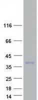 Coomassie blue staining of purified TARM1 protein