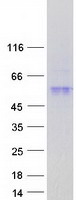 Coomassie blue staining of purified PRRT4 protein
