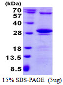 3ug by SDS-PAGE under reducing condition and visualized by coomassie blue stain.