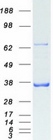 Coomassie blue staining of purified PDLIM1 protein