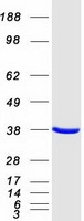 Coomassie blue staining of purified AIP protein